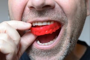A man inserts a red appliance into his mouth to see if night guards are right for him