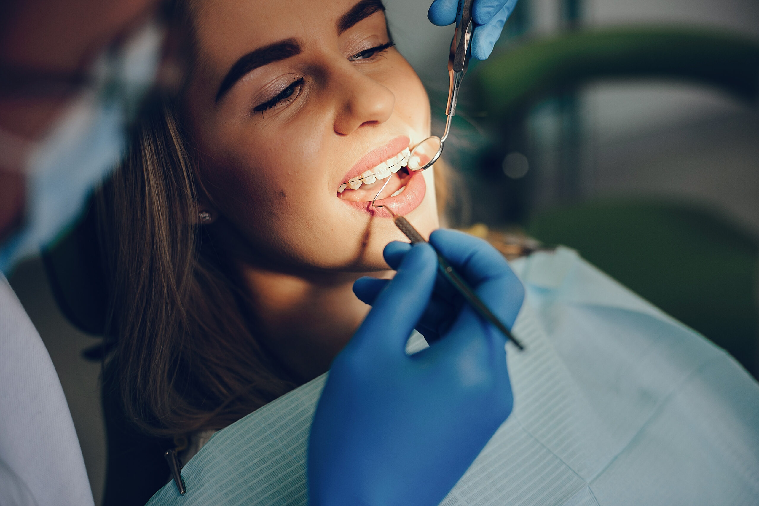 Caring for Your Smile: A Friendly Guide to Orthodontics in Houston 4