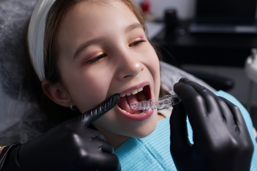 Orthodontic Care for Children: When is the Right Time to Start? 23