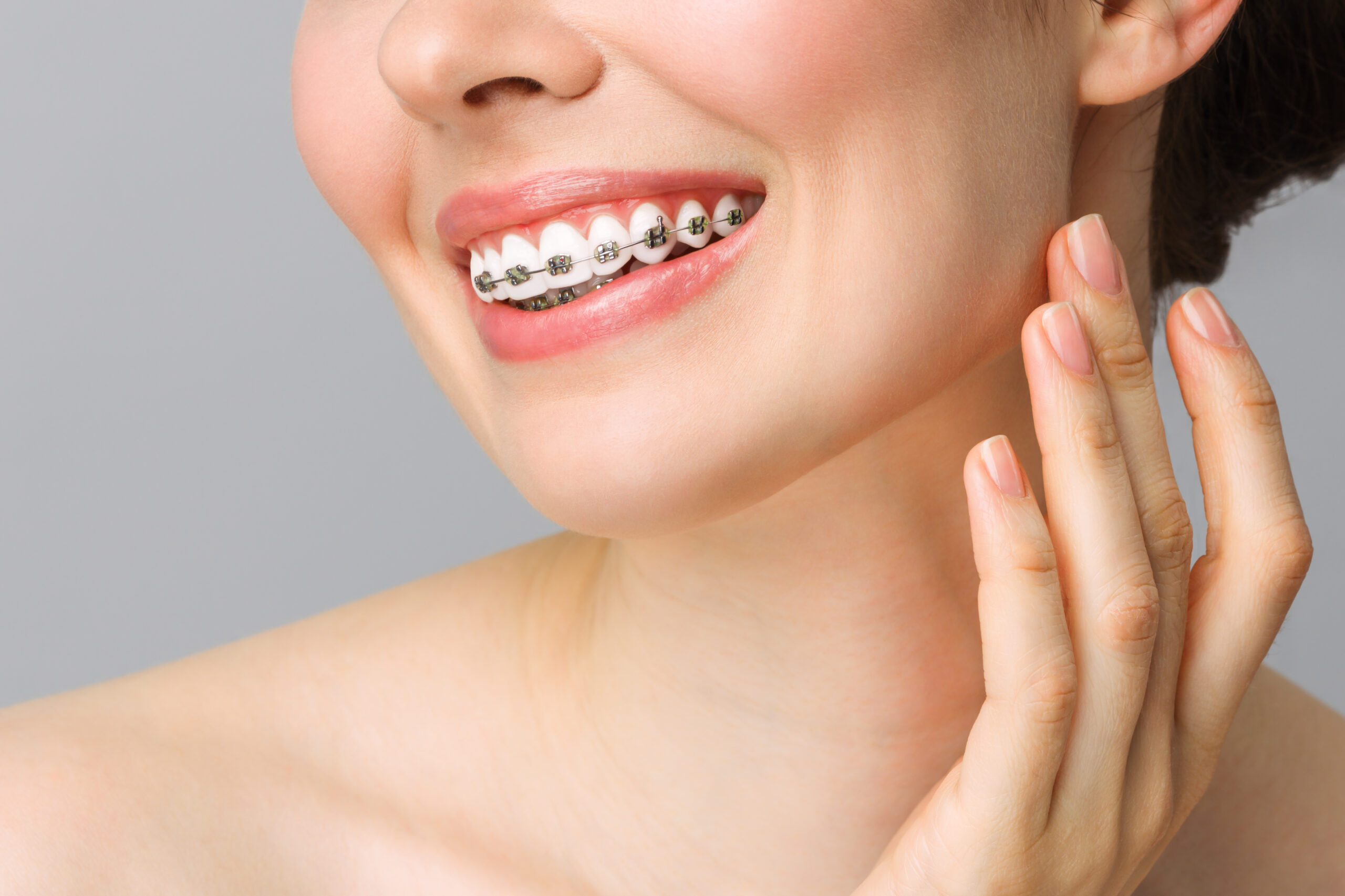 Caring for Your Smile: A Friendly Guide to Orthodontics in Houston 2