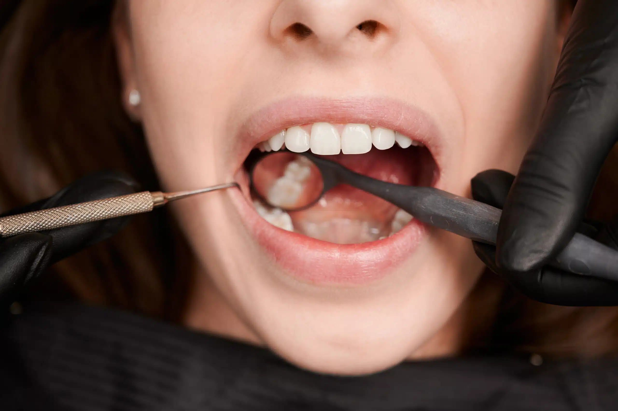 Orthodontic Care in Houston for All Ages