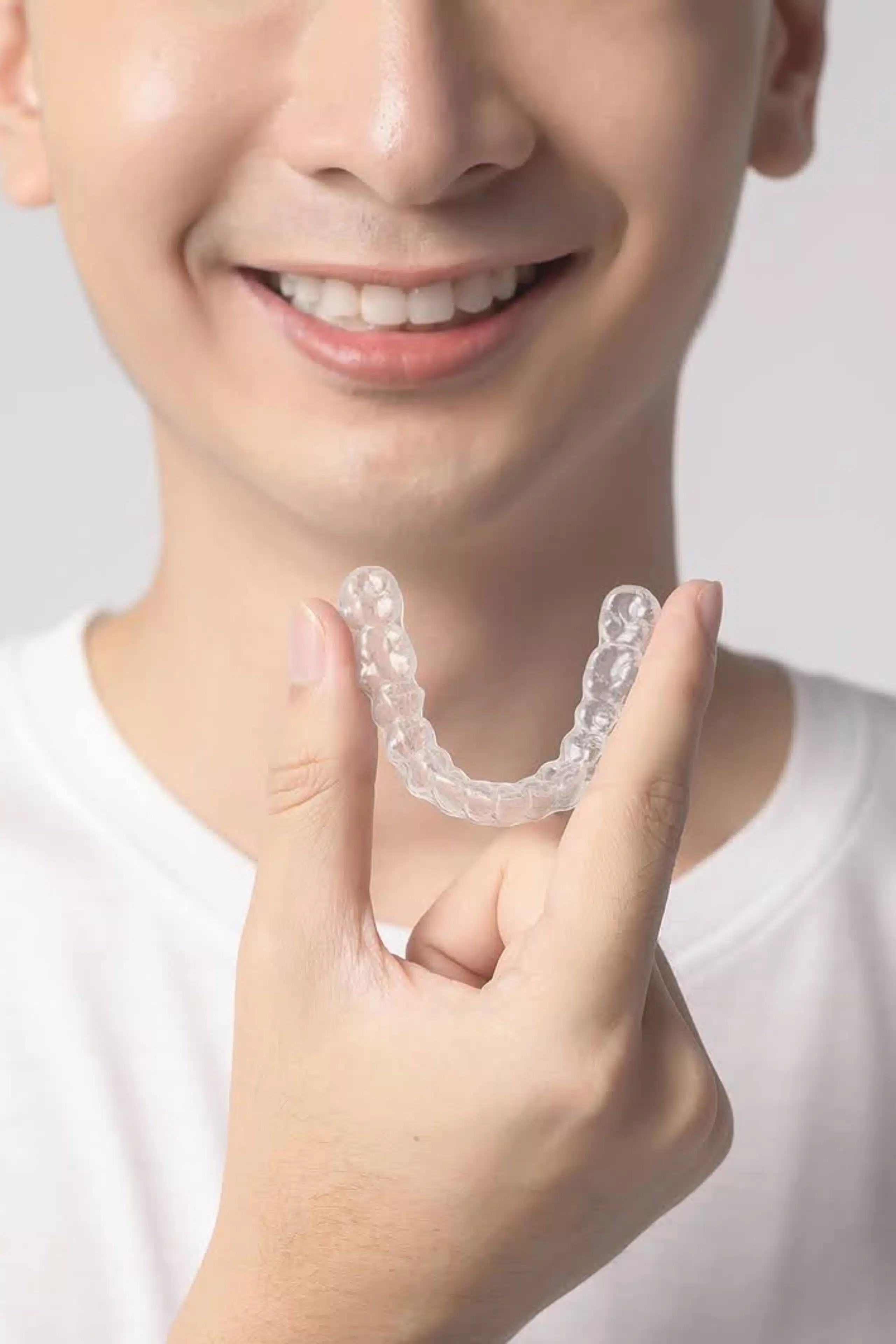 Aligners for Manvel Invisalign Provider in Houston